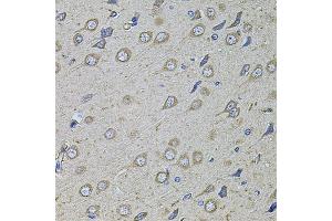 Immunohistochemistry of paraffin-embedded rat brain using COL1A2 antibody. (COL1A2 antibody)