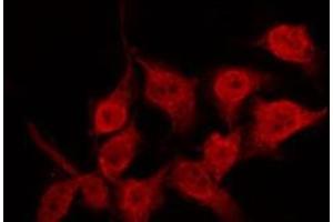 Immunofluorescence (fixed cells) (IF/ICC) image for anti-Tumor Protein P53 (TP53) (pSer20) antibody (ABIN6255078)
