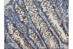 Immunohistochemical staining of paraffin-embedded Human colon tissue using anti-SENP2 mouse monoclonal antibody.