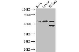 Western Blot Positive WB detected in: Hela whole cell lysate, Mouse liver tissue, Mouse kidney tissue All lanes: EHD2 antibody at 3 μg/mL Secondary Goat polyclonal to rabbit IgG at 1/50000 dilution Predicted band size: 62, 47 kDa Observed band size: 62, 47 kDa (EHD2 antibody  (AA 401-543))