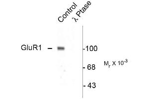 Western blots of rat hippocampal lysate showing specific immunolabeling of the ~100k GluR1 protein phosphorylated at Ser845 (Control). (Glutamate Receptor 1 antibody  (pSer845))