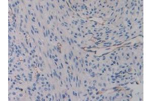 Detection of ITGb3 in Mouse Uterus Tissue using Polyclonal Antibody to Integrin Beta 3 (ITGb3) (Integrin beta 3 antibody  (AA 134-376))