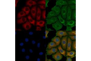 ABIN6256835 and ABIN6273684 staining Hela cells by IF/ICC.