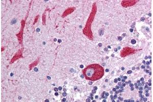 Human Brain, Cerebellum (formalin-fixed, paraffin-embedded) stained with TLR7 antibody ABIN214002 at 5 ug/ml followed by biotinylated goat anti-rabbit IgG secondary antibody ABIN481713, alkaline phosphatase-streptavidin and chromogen. (TLR7 antibody)