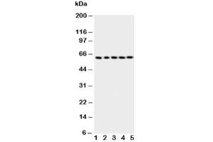 Western Blotting (WB) image for anti-T-Complex 1 (TCP1) (AA 82-98) antibody (ABIN3029087)