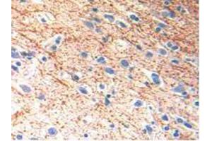 IHC-P analysis of Human Brain Tissue, with DAB staining. (IL-13 antibody  (AA 25-146))