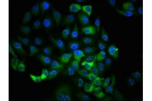 Immunofluorescence staining of Hela cells with ABIN7127744 at 1:100,counter-stained with DAPI. (Recombinant RPS6KA1 antibody  (pSer363, pThr359))