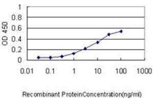 Detection limit for recombinant GST tagged RIPK4 is approximately 0. (RIPK4 antibody  (AA 675-784))