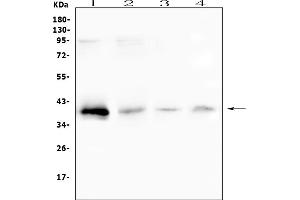 Western blot analysis of RP2 using anti-RP2 antibody (ABIN6719513). (RP2 antibody  (AA 244-348))