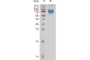 Human IL2RG Protein, hFc Tag on SDS-PAGE under reducing condition.