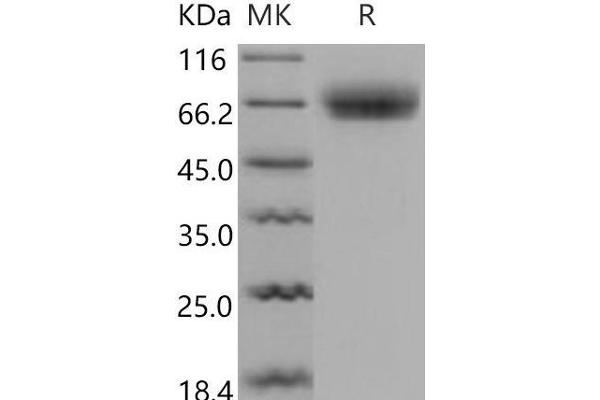 Osteomodulin Protein (OMD) (His tag)