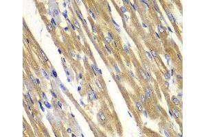 Immunohistochemistry of paraffin-embedded Rat heart using TYR Polyclonal Antibody at dilution of 1:100 (40x lens). (TYR antibody)