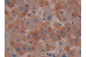 Detection of COX 2 in Human Liver Tissue using Polyclonal Antibody to Cyclooxygenase-2 (COX 2) (PTGS2 antibody  (AA 187-425))