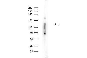 anti-Keratin 1 (KRT1) (N-Term) antibody