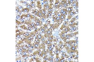 Immunohistochemistry of paraffin-embedded rat liver using  antibody (ABIN7265709) at dilution of 1:100 (40x lens).