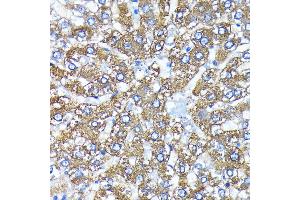 Immunohistochemistry of paraffin-embedded rat liver using  antibody (ABIN7265709) at dilution of 1:100 (40x lens). (ATG3 antibody)