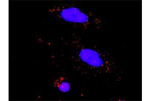 anti-Protein Phosphatase 2, Regulatory Subunit B', gamma (PPP2R5C) (AA 1-100) antibody