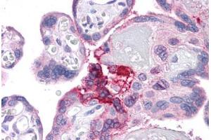 Human Placenta: Formalin-Fixed, Paraffin-Embedded (FFPE) (ESX Homeobox 1 antibody  (Internal Region))