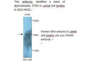 Image no. 1 for anti-PRKC, Apoptosis, WT1, Regulator (PAWR) antibody (ABIN790827)