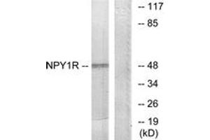 Western blot analysis of extracts from NIH-3T3 cells, using NPY1R Antibody. (NPY1R antibody  (AA 221-270))