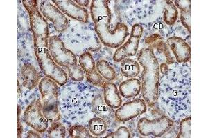 Expression of Kir5. (KIR5.1 antibody  (C-Term, Intracellular))