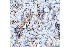 IHC analysis of CD31/Pecam1 using anti-CD31/Pecam1 antibody (ABIN7601662).