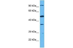 Host:  Rabbit  Target Name:  SUN1  Sample Tissue:  Human HCT116 Whole Cell  Antibody Dilution:  1ug/ml (SUN1 antibody  (N-Term))