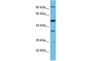 Host:  Rabbit  Target Name:  SUN1  Sample Tissue:  Human HCT116 Whole Cell  Antibody Dilution:  1ug/ml (SUN1 antibody  (N-Term))