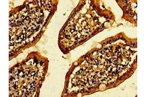 Immunohistochemistry of paraffin-embedded human small intestine tissue using ABIN7175009 at dilution of 1:100 (CXorf56 antibody  (AA 1-222))