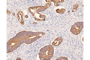 Immunohistochemistry (IHC) image for anti-Keratin 8 (KRT8) (C-Term) antibody (ABIN870548) (KRT8 antibody  (C-Term))