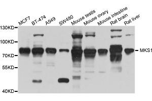 Western blot analysis of extracts of various cell lines, using MKS1 antibody (ABIN5995499) at 1/1000 dilution. (MKS1 antibody)
