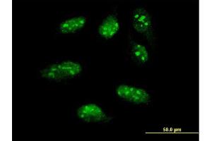Immunofluorescence of monoclonal antibody to LHX1 on HeLa cell. (LHX1 antibody  (AA 1-100))