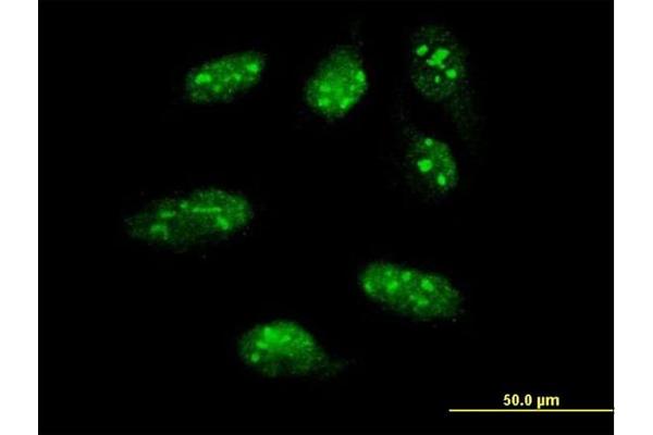 LHX1 antibody  (AA 1-100)