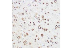 Immunohistochemistry of paraffin-embedded rat brain using NOMO1 Rabbit pAb (ABIN6128346, ABIN6144710, ABIN6144711 and ABIN6214793) at dilution of 1:350 (40x lens). (NOMO1 antibody  (AA 700-1000))