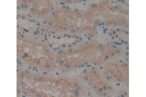 IHC-P analysis of Kidney tissue, with DAB staining. (CAMLG antibody  (AA 19-184))