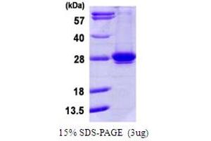 SDS-PAGE (SDS) image for RAB35, Member RAS Oncogene Family (RAB35) (AA 1-203) protein (His tag) (ABIN667954) (RAB35 Protein (AA 1-203) (His tag))