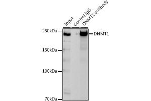 Immunoprecipitation analysis of 300 μg extracts of Jurkat cells using 3 μg DNMT1 antibody (ABIN7266812). (DNMT1 antibody)