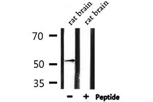 Western blot analysis of extracts from rat brain , using ADRA1A Antibody. (alpha 1 Adrenergic Receptor antibody  (Internal Region))