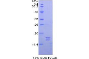SDS-PAGE analysis of Human Glycocalicin Protein. (Glycocalicin Protein)