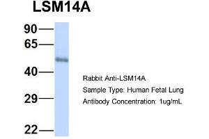 Host: Rabbit  Target Name: LSM14A  Sample Tissue: Human Fetal Lung  Antibody Dilution: 1. (LSM14A antibody  (C-Term))