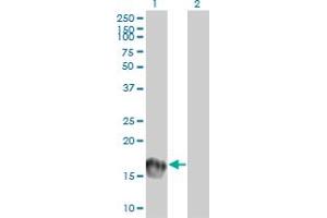 Western Blot analysis of UBE2C expression in transfected 293T cell line by UBE2C monoclonal antibody (M01), clone 9D3. (UBE2C antibody  (AA 70-179))