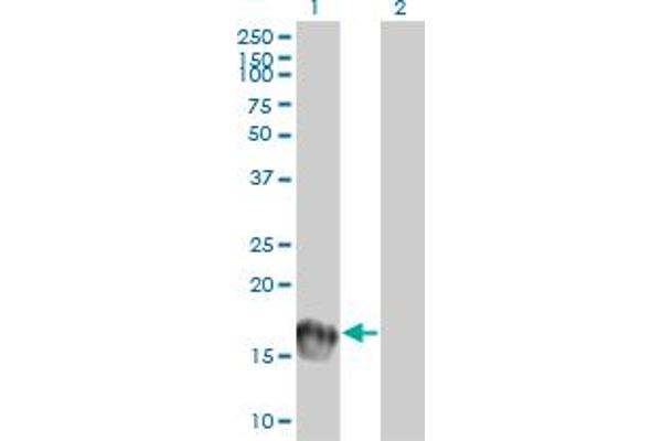UBE2C Antikörper  (AA 70-179)