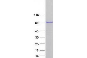 Western Blotting (WB) image for Exocyst Complex Component 8 (EXO84) protein (Myc-DYKDDDDK Tag) (ABIN2720615)
