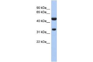 WB Suggested Anti-SULT1B1 Antibody Titration:  0. (SULT1B1 antibody  (N-Term))