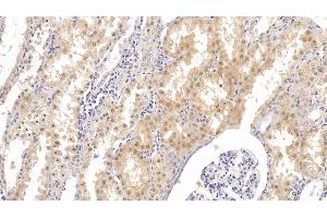Detection of PTHR2 in Human Kidney Tissue using Monoclonal Antibody to Parathyroid Hormone Receptor 2 (PTHR2) (PTH2R antibody  (AA 27-145))