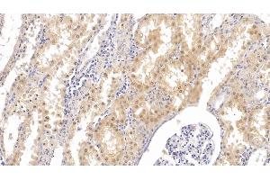Detection of PTHR2 in Human Kidney Tissue using Monoclonal Antibody to Parathyroid Hormone Receptor 2 (PTHR2)
