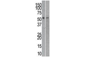 Reptin antibody used in western blot to detect RUVBL2 in mouse kidney (left) and SK-Br-3 (right) lysate