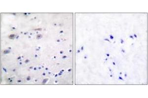 Immunohistochemistry analysis of paraffin-embedded human brain, using Opioid Receptor (Phospho-Ser375) Antibody. (Opioid Receptor (AA 341-390), (pSer377) antibody)
