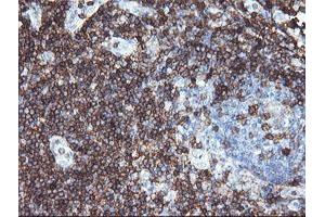 Image no. 1 for anti-CD3 epsilon (CD3E) antibody (ABIN1497222) (CD3 epsilon antibody)