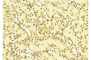ABIN6268843 at 1/100 staining Mouse liver tissue by IHC-P.